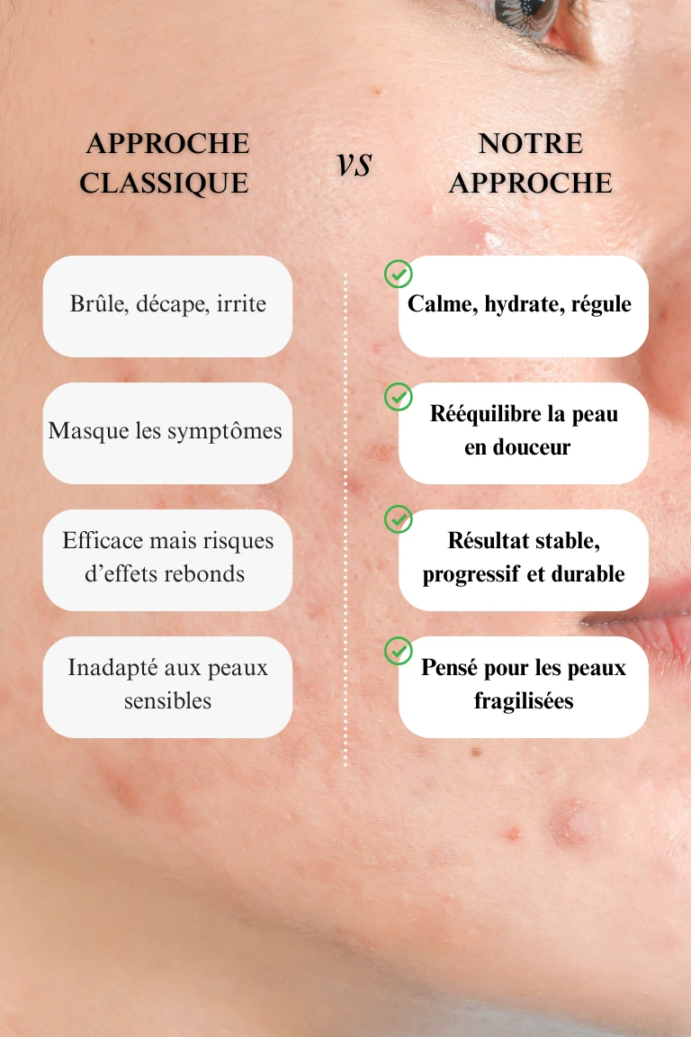 Approche classique versus régulation douce -- lotion-anti imperfection GRASSFIELD by Ruth